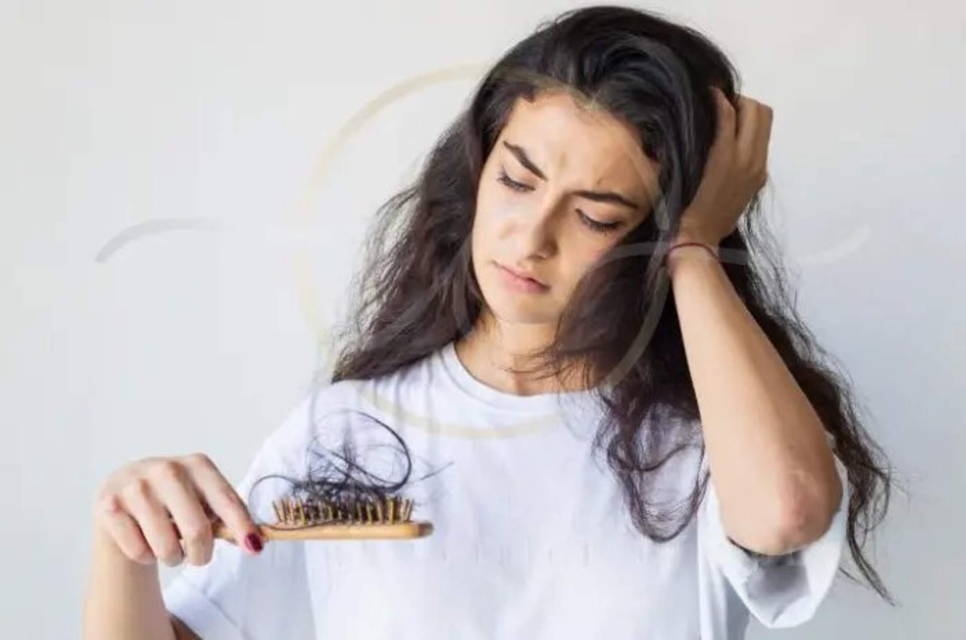Cause comuni della perdita di capelli nelle donne.
