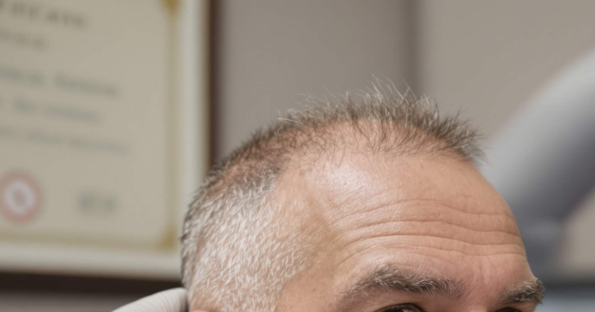 Tratamento Capilar PRP: Como Funciona e O Que Esperar