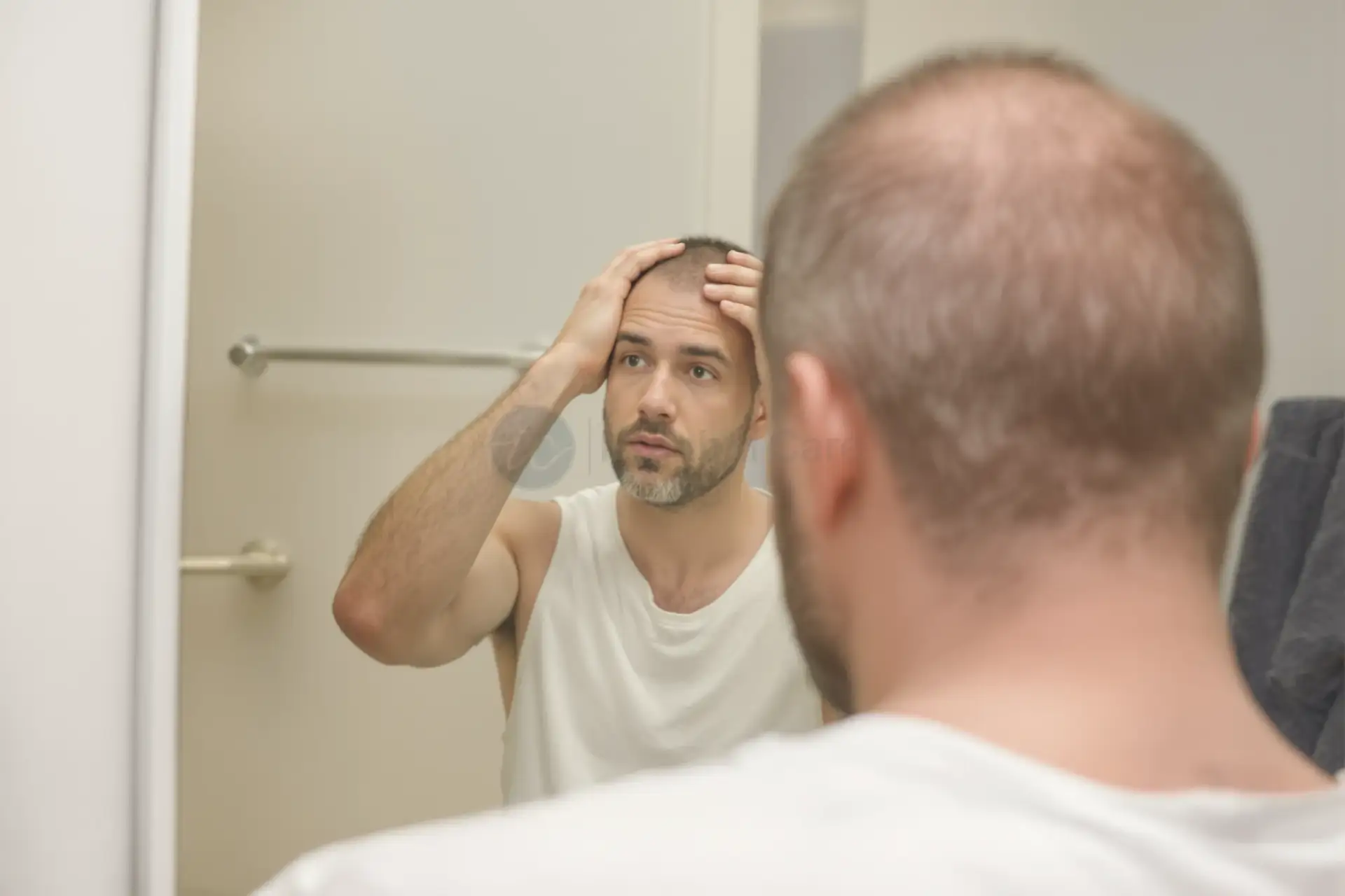 Quando aspettarsi i risultati del trapianto di capelli