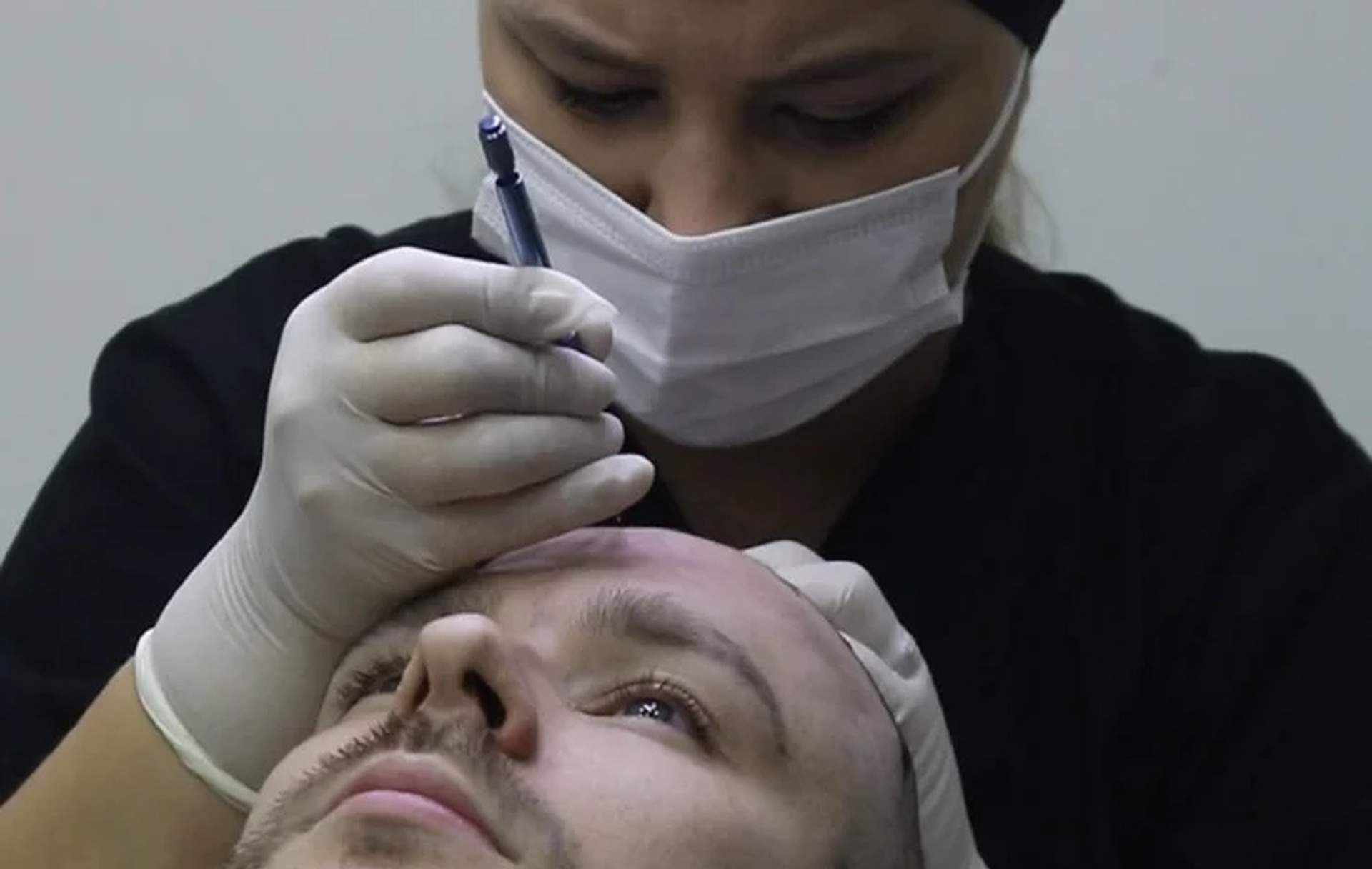 Trattamento per capelli con cellule staminali: cos'è e come funziona — Istanbul Care