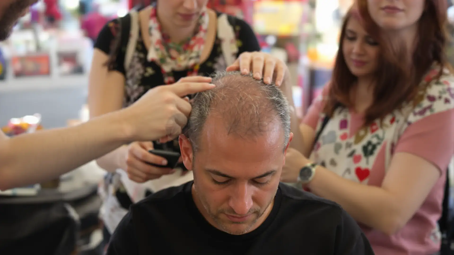 Valutazione del cuoio capelluto prima di un trapianto di capelli in una clinica di Istanbul