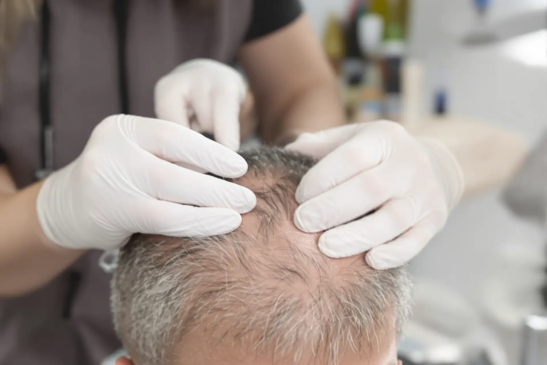 Costo Trapianto Capelli Turchia 2026: Analisi Completa dei Prezzi