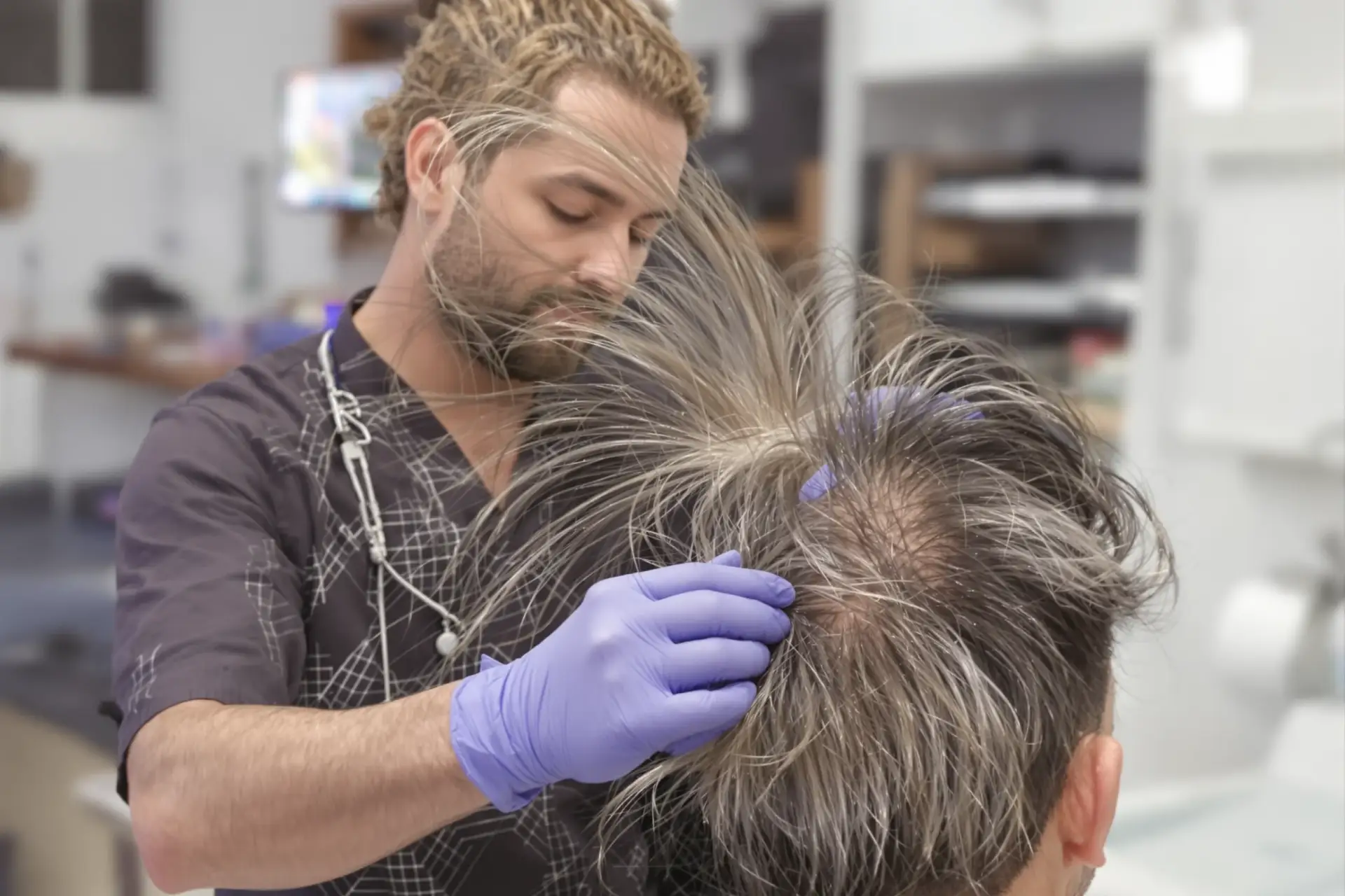 Tasso di Successo del Trapianto di Capelli in Turchia: I Fatti