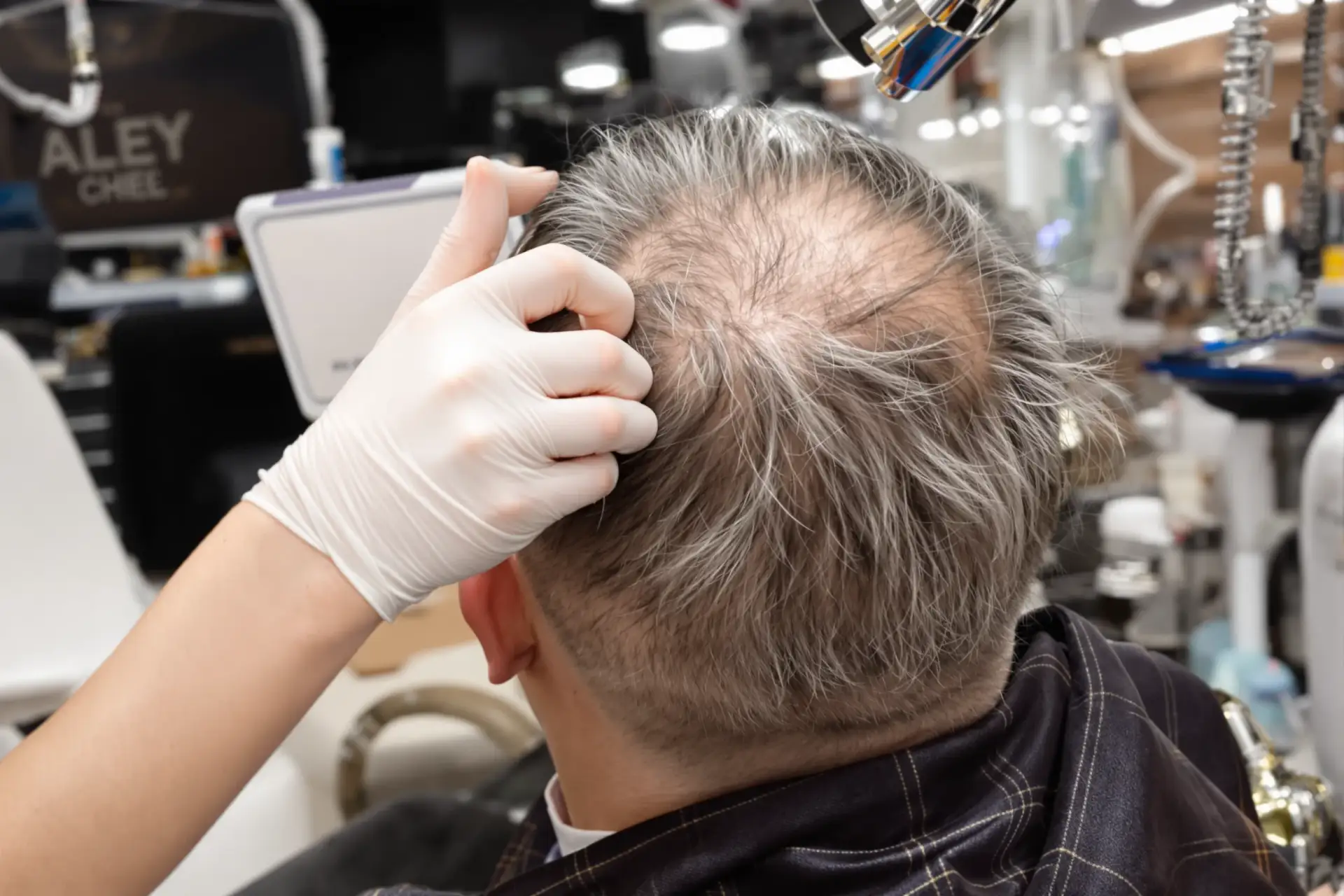 Trapianto di capelli a Harley Street: quanto costa davvero