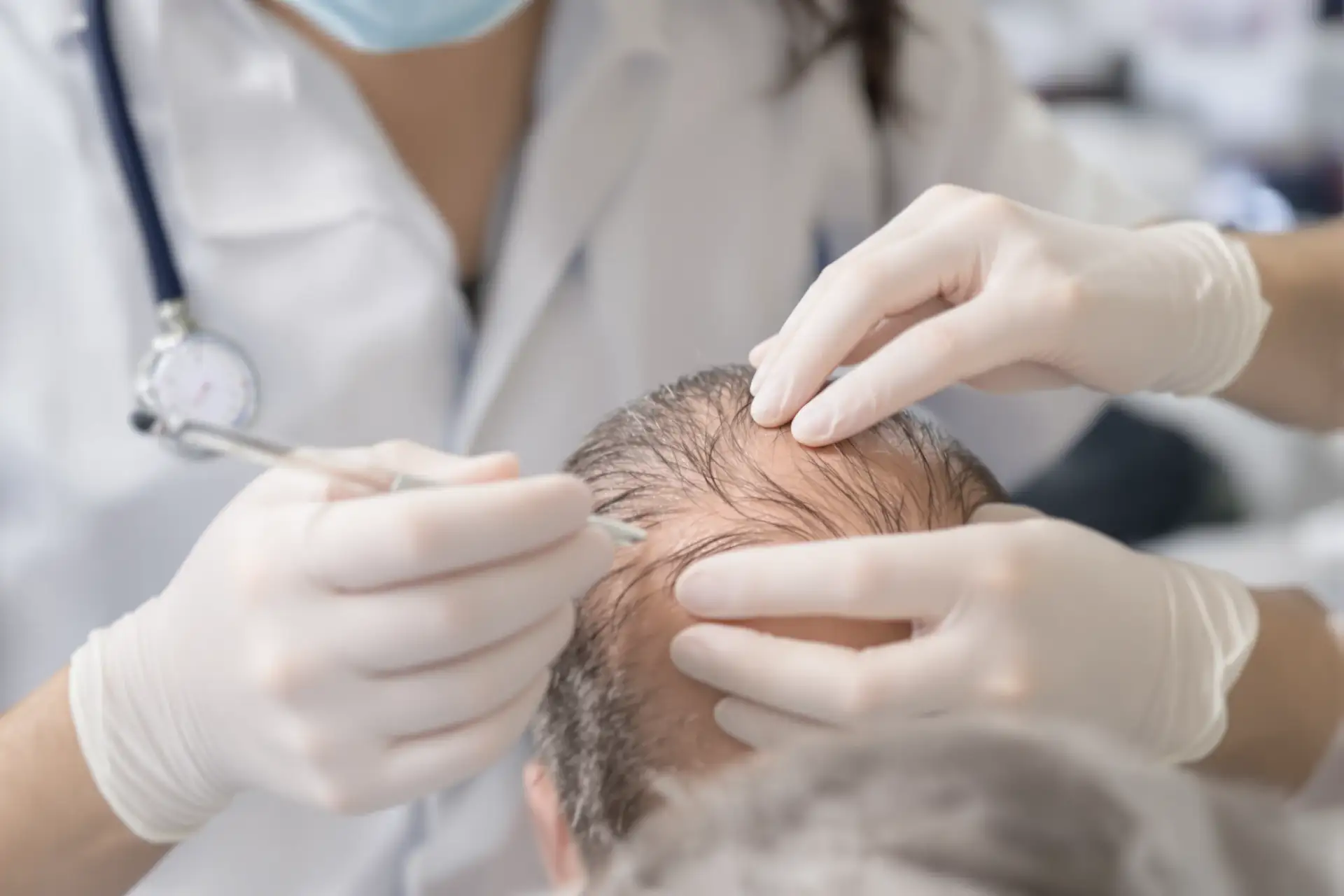 Sicurezza Trapianto Capelli Turchia 2026: Verdetto Basato sui Dati