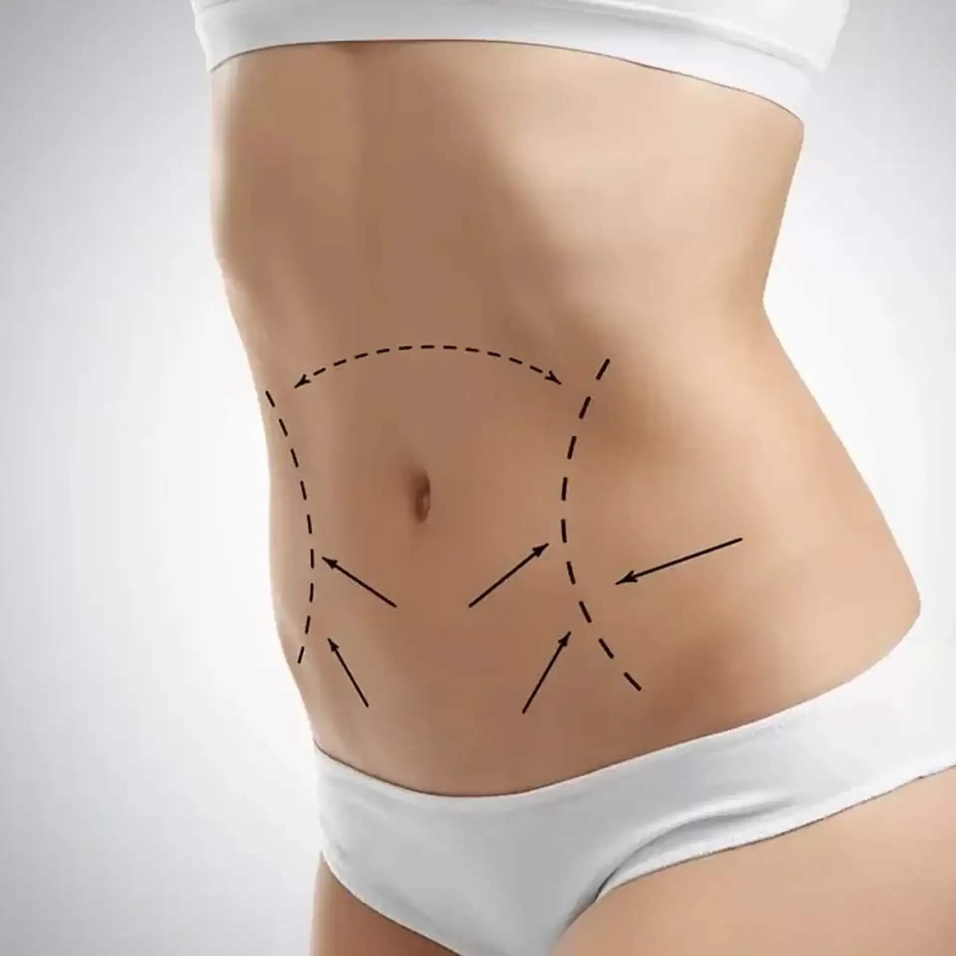 recovery-time-for-tummy-tuck-turkey