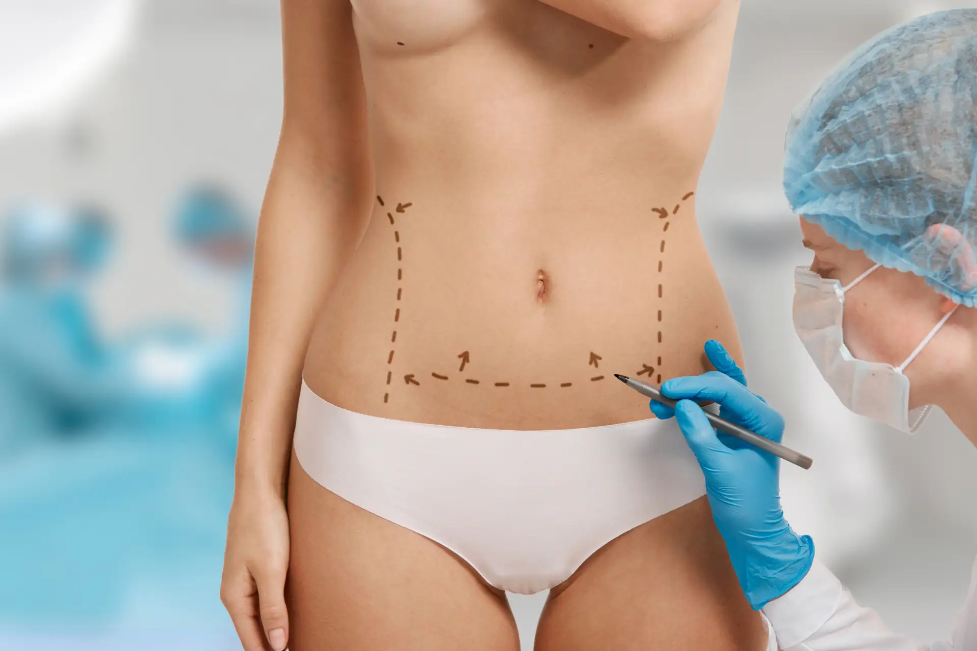 mujer-marcada-cirugia-estetica