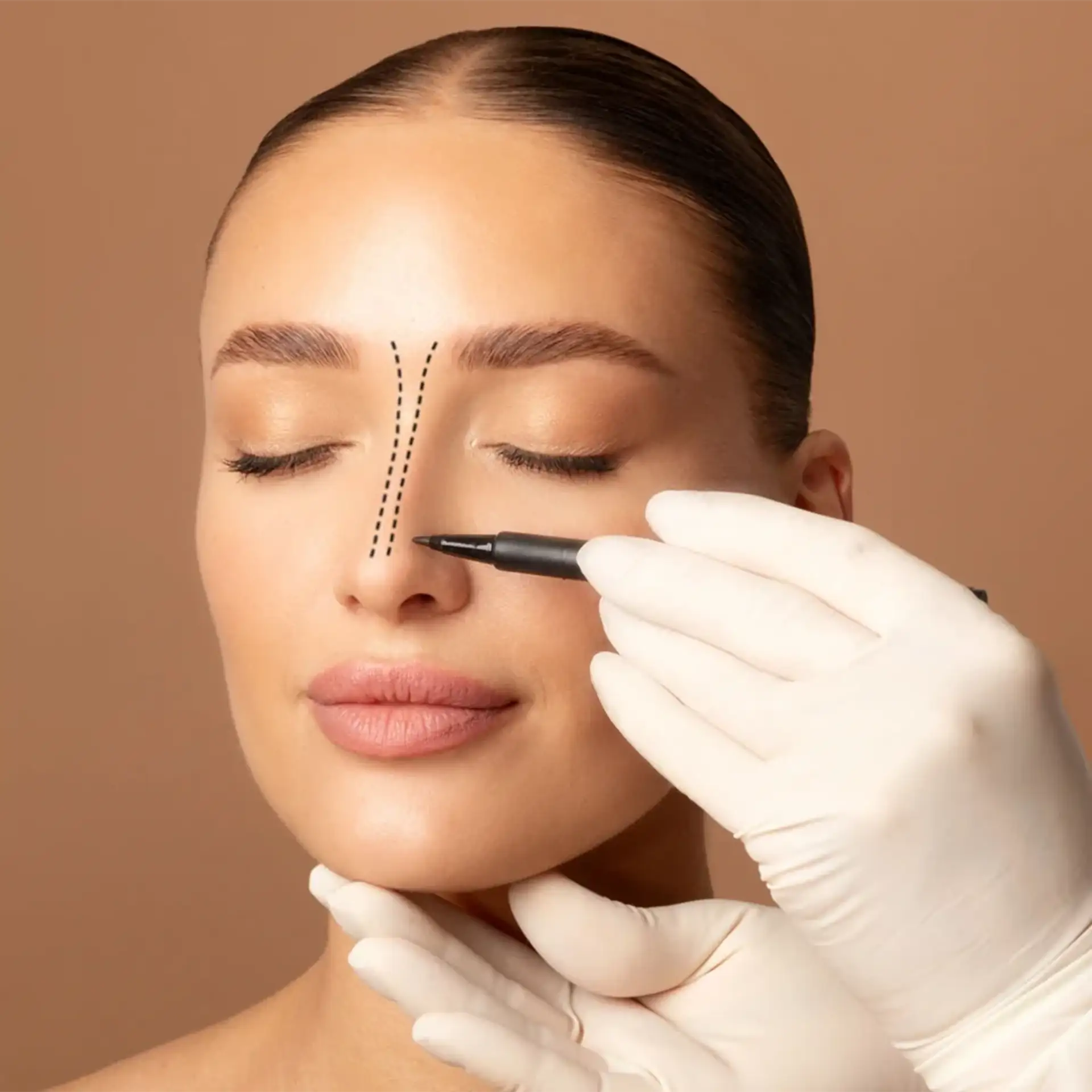 ce-este-rinoplastia- curcan