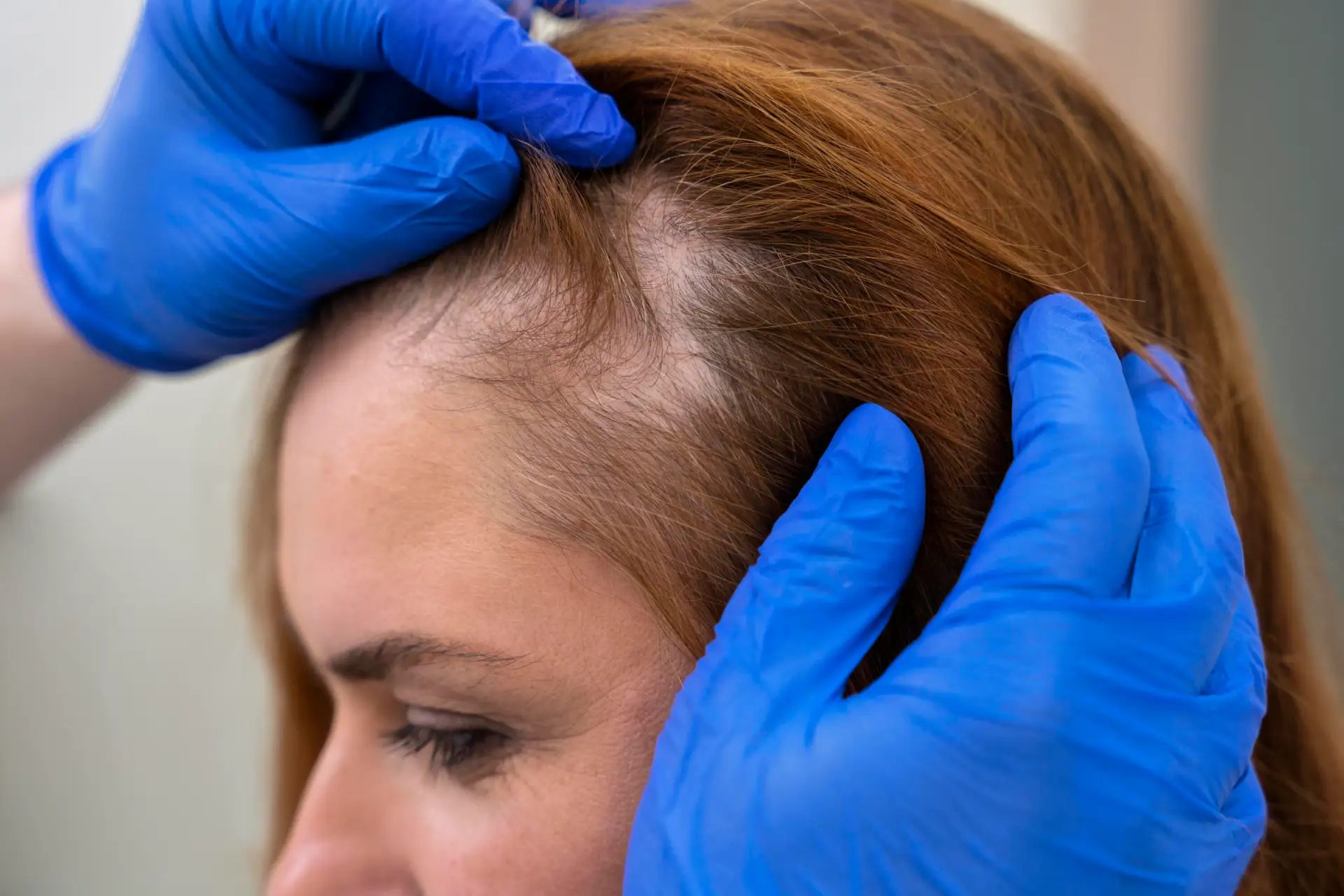 woman-hair-loss-treatment-clinic