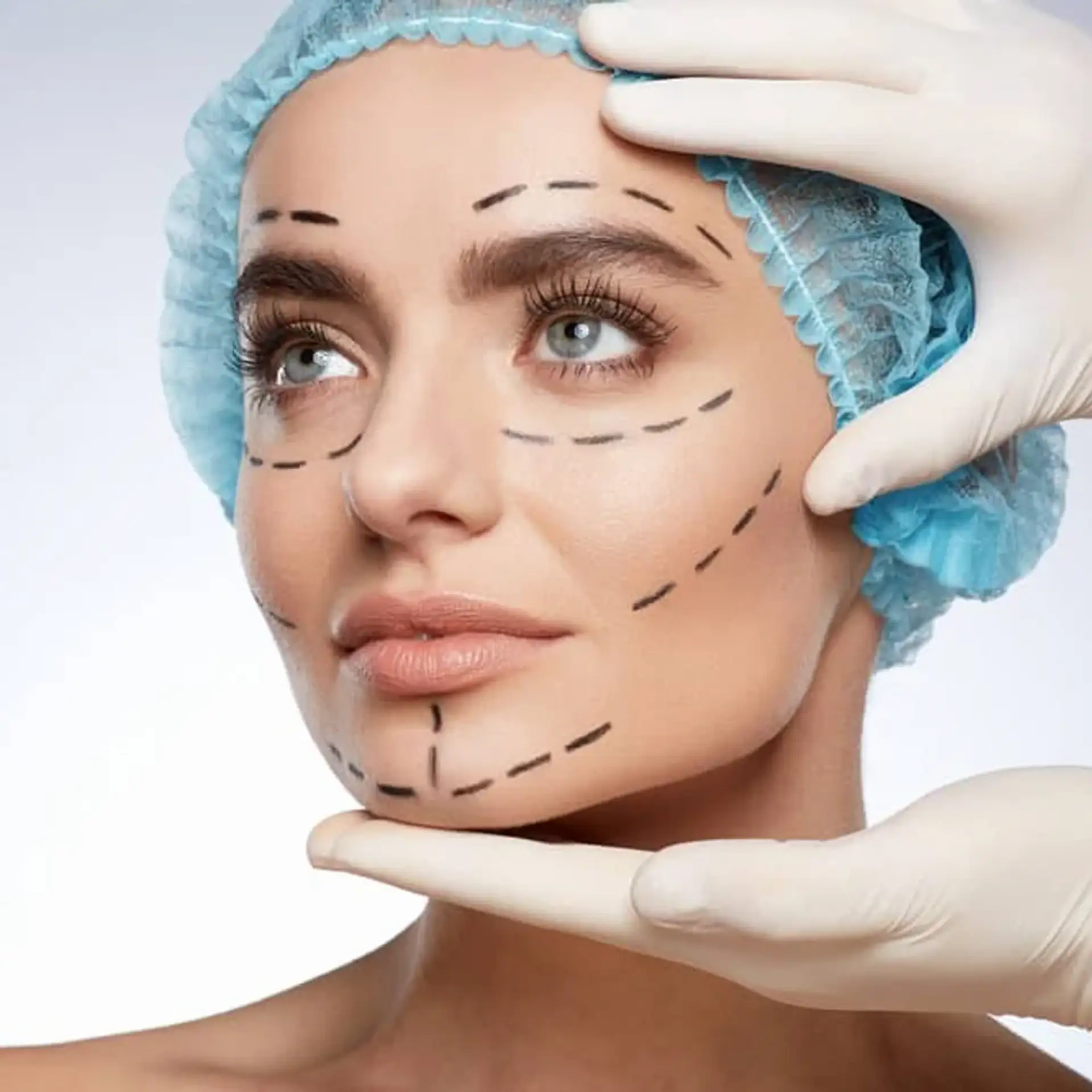 types-face-lift-surgery