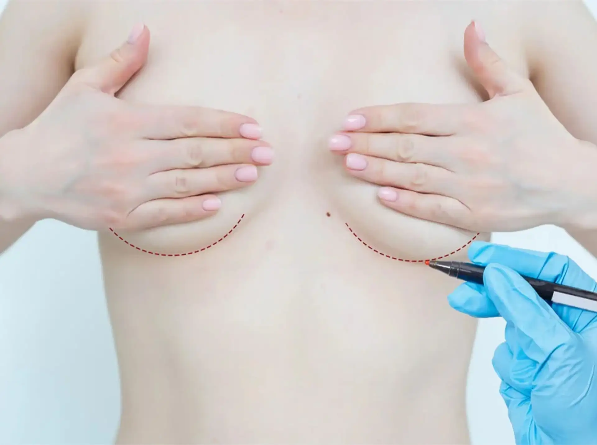 goal-of-the entire-breast-reduction