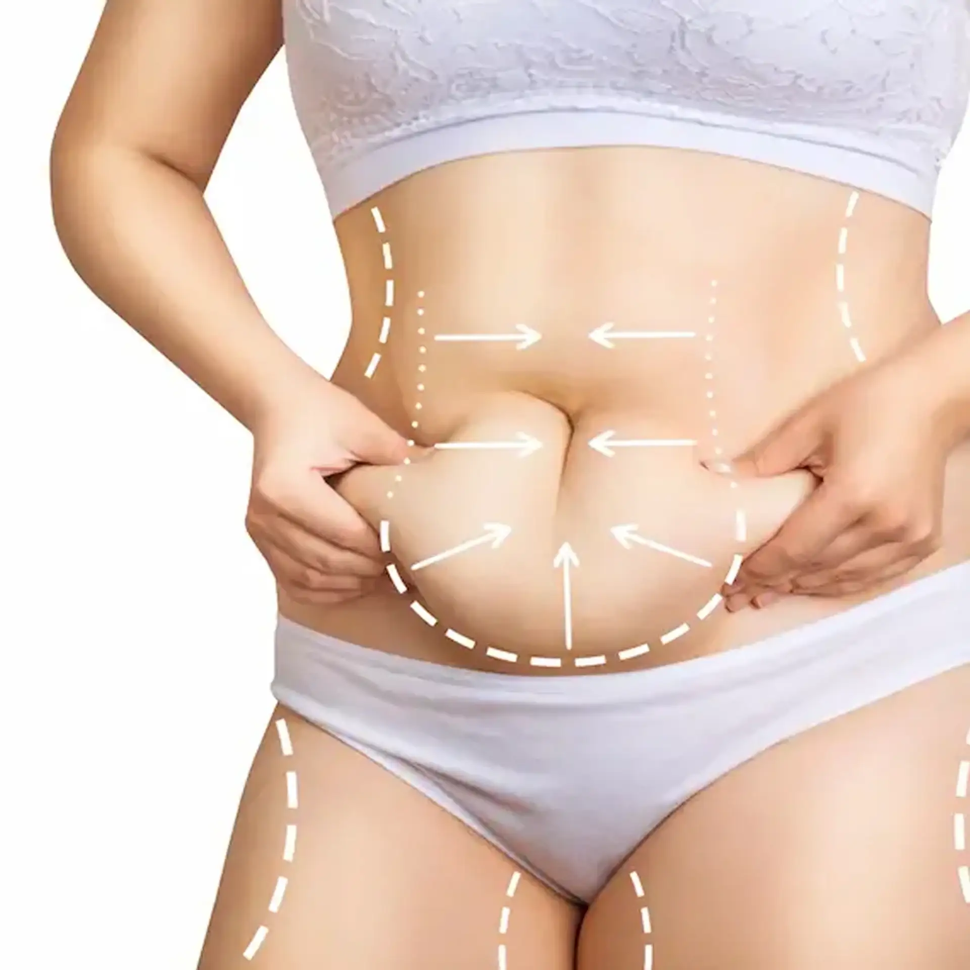 que-es-la-abdominoplastia-pavo
