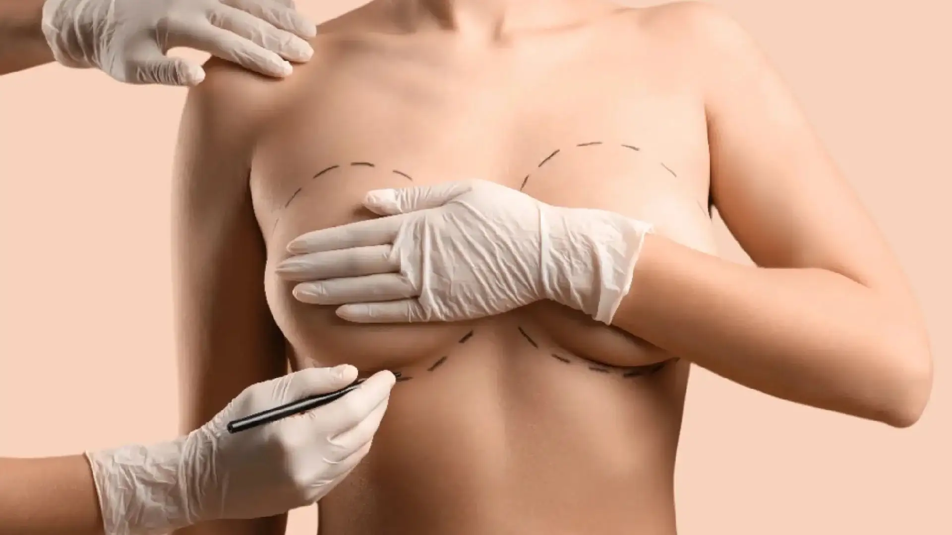 close-set-breast-enlargement