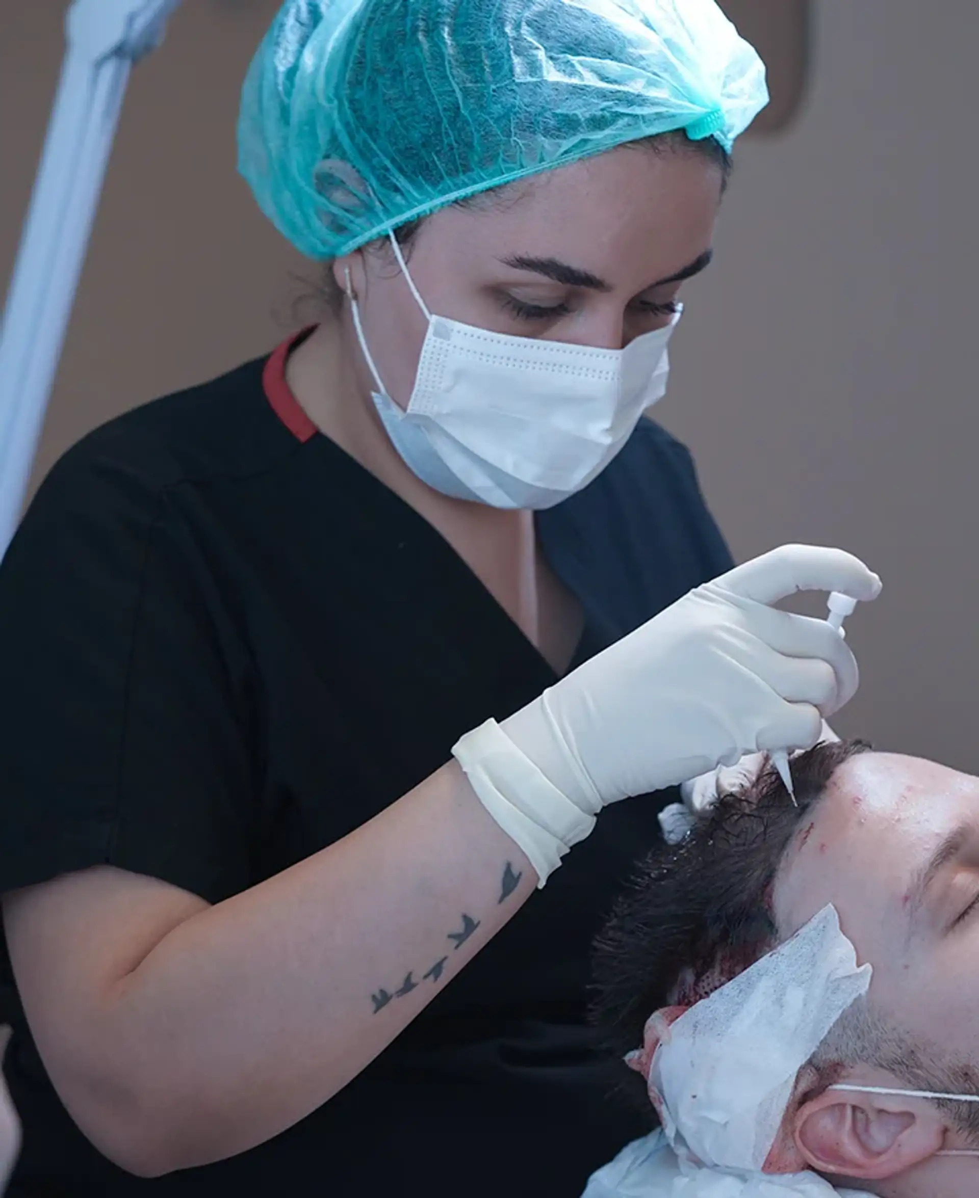 trapianto-di-capelli-royal-hair-istanbul