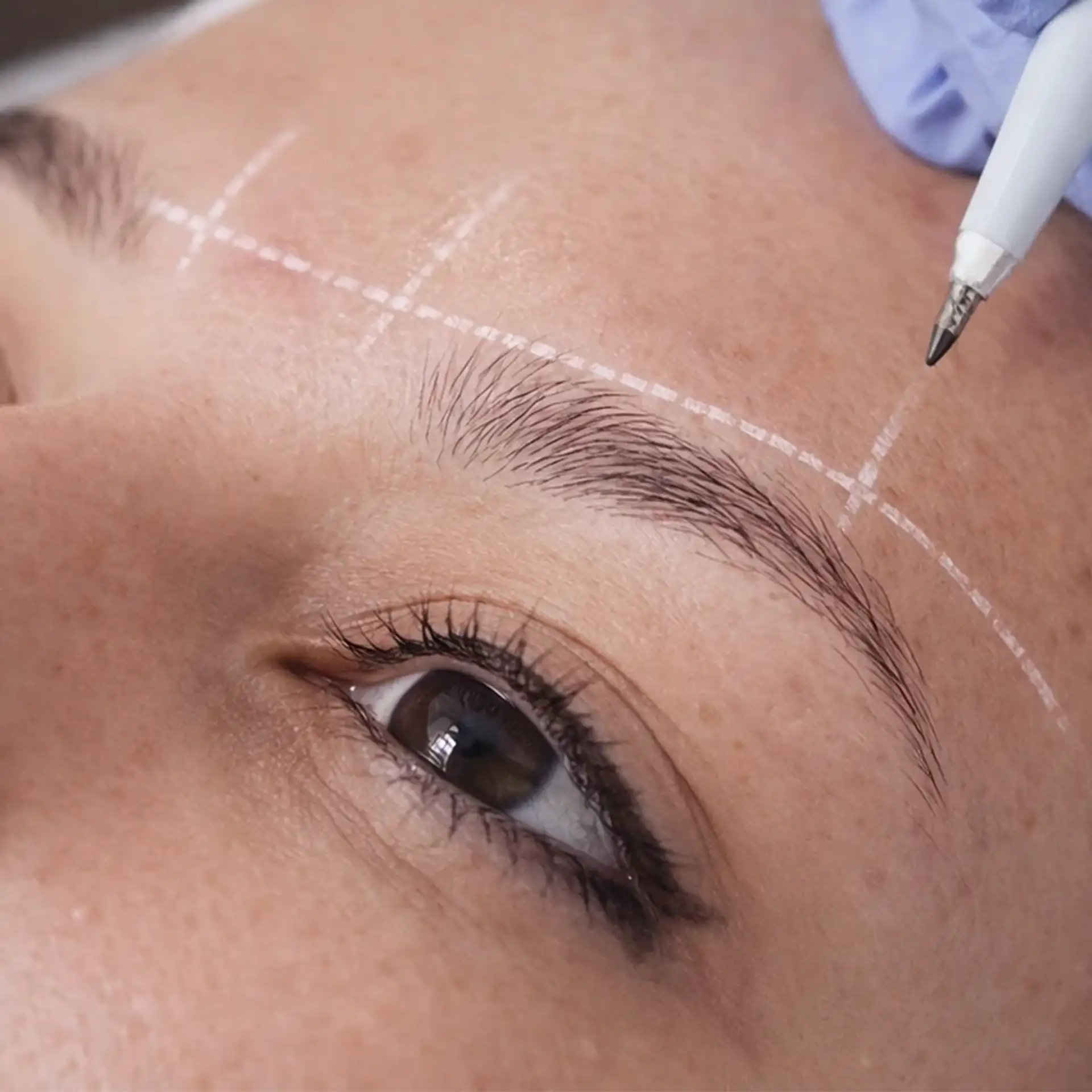 solutions- complete-eyebrow-absence