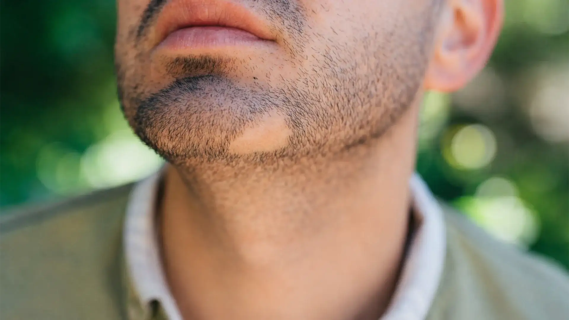 restaurar-el-crecimiento-del-cabello-quemaduras-lesiones-cicatrices