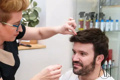 non surgical hair loss solutions