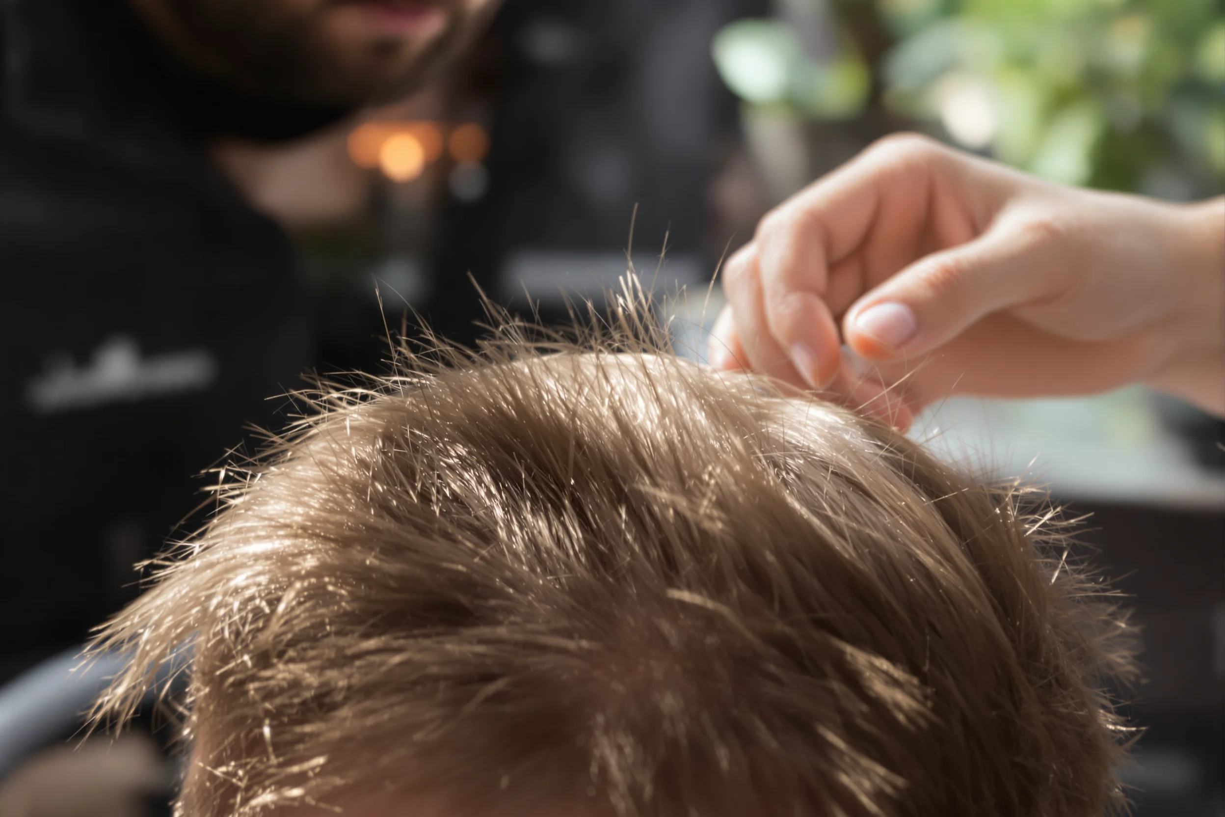 Costo del Trapianto di Capelli: Un Confronto Globale