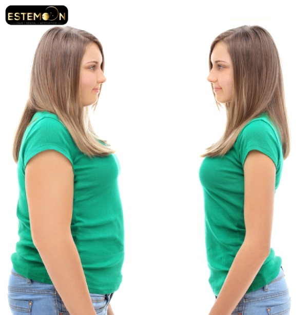 types of bariatric surgery