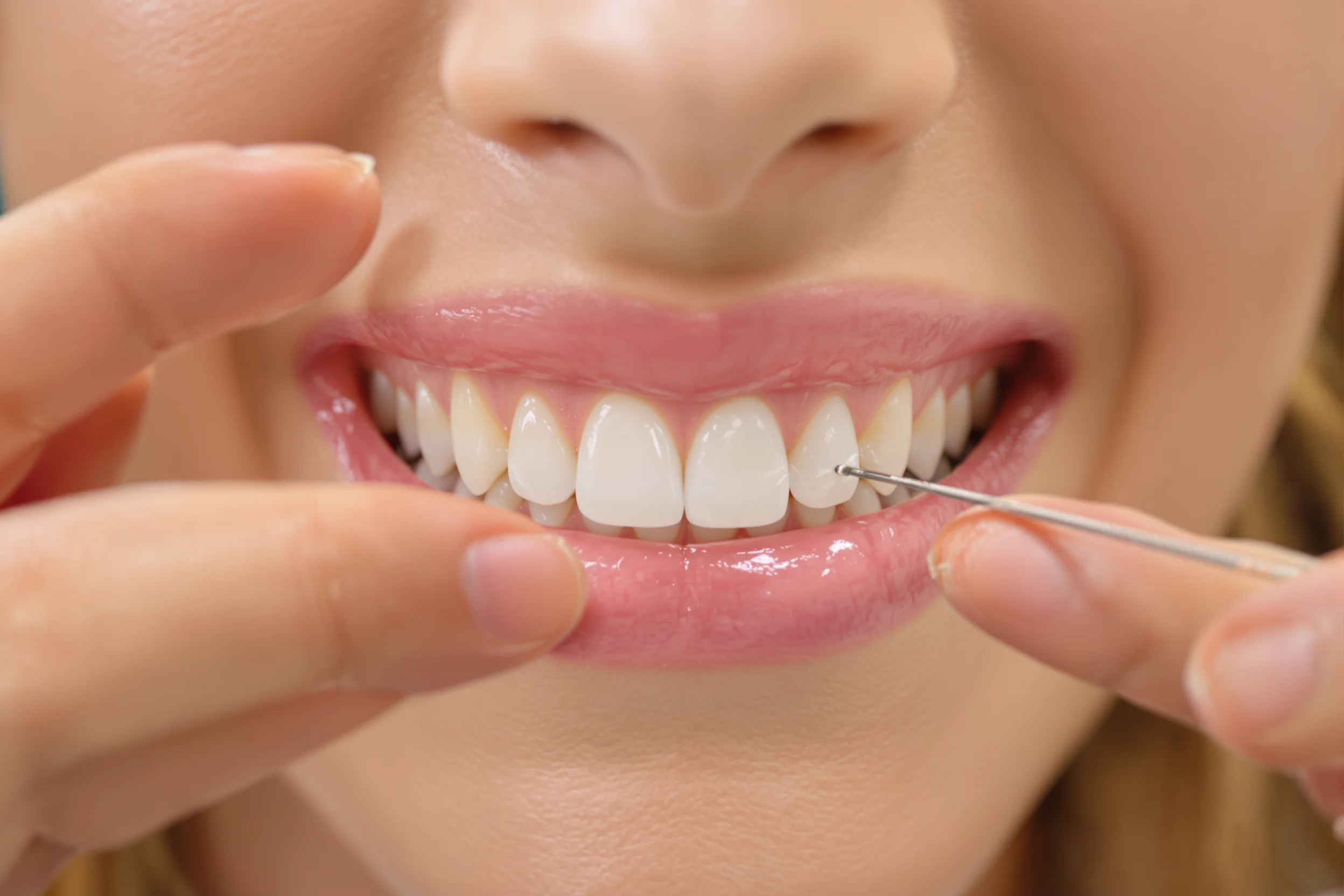 Dental Bridge vs Implant: Cost UK
