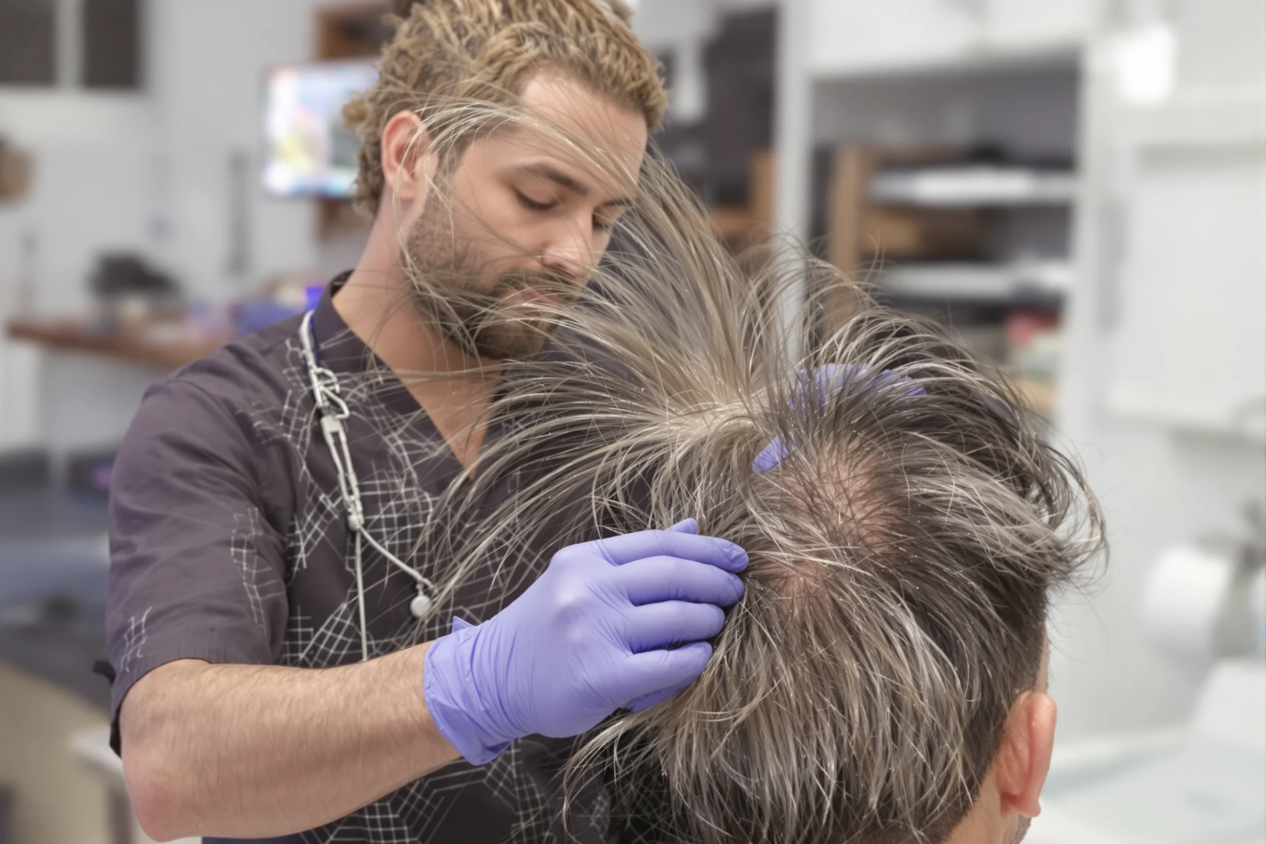 Tasso di Successo del Trapianto di Capelli in Turchia: I Fatti