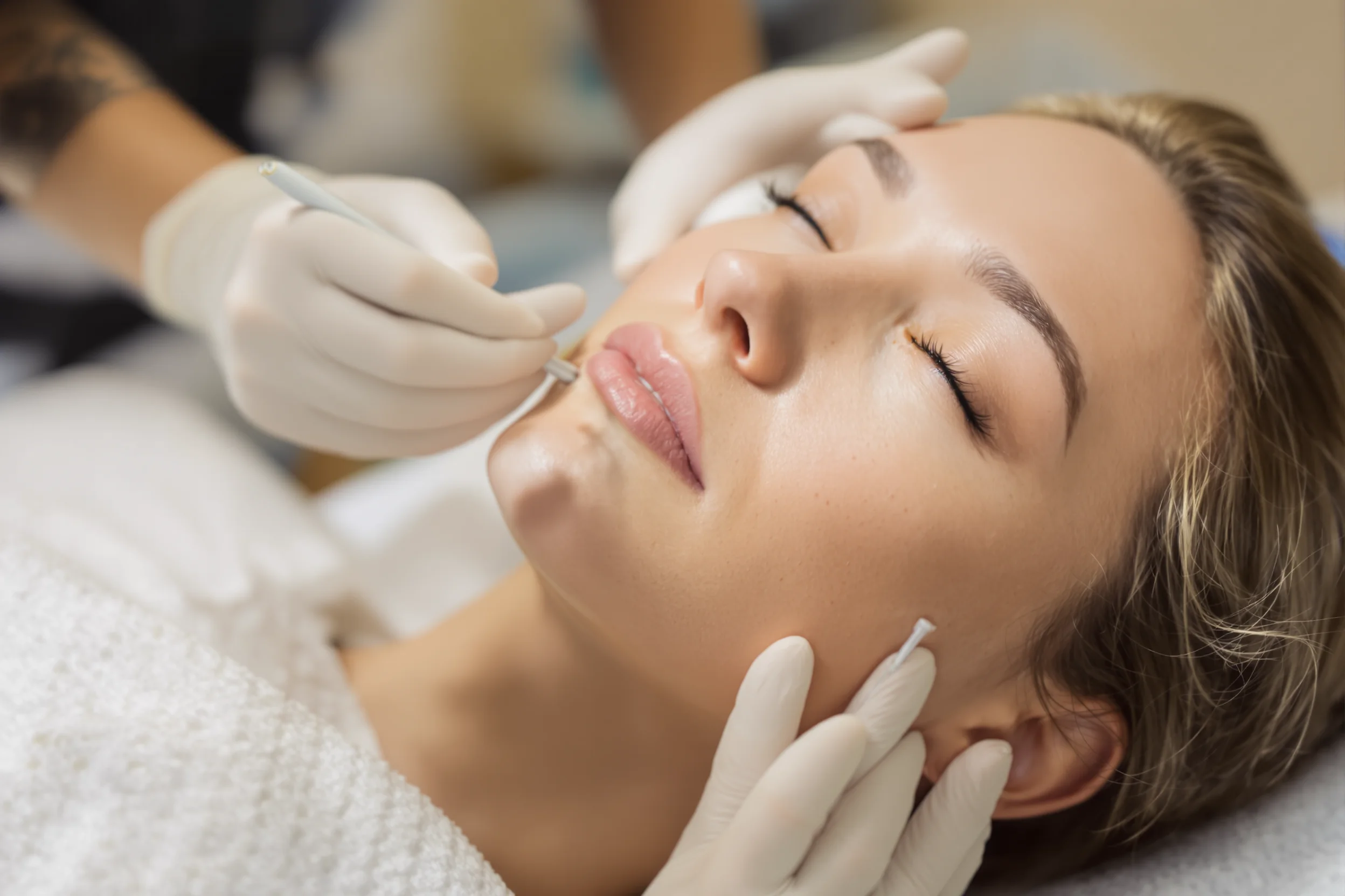 Filler in Temples to Lift Eyes Explained